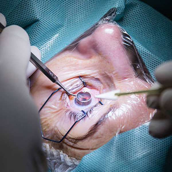 arthroscopy